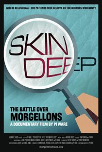 دانلود مستند Skin Deep: The Battle Over Morgellons 2019104233-558282736